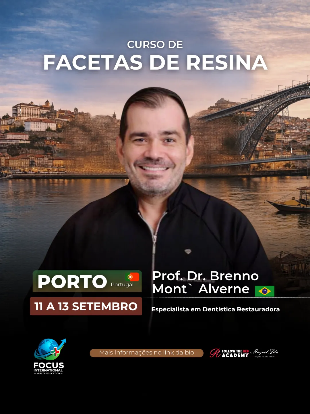 Resin Veneers - Porto